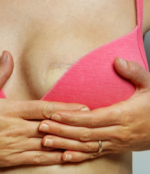 Sinə Rekonstruksiyası Sinə Rekonstruksiyası ilə döşün simmetriyası və estetik görünüşü bərpa edilir