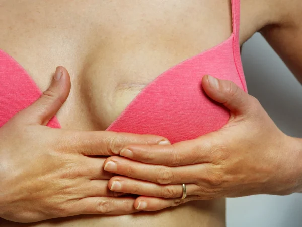 Sinə Rekonstruksiyası ilə döşün simmetriyası və estetik görünüşü bərpa edilir