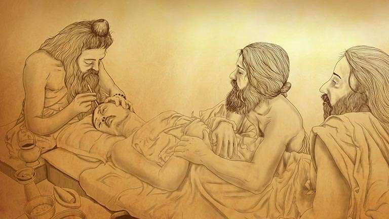 Sushruta Samhita adlı qədim hind tibbi mənbəsində burun rekonstruksiyası ilə bağlı ilk sənədləşdirilmiş əməliyyatlar haqqında məlumatlar var